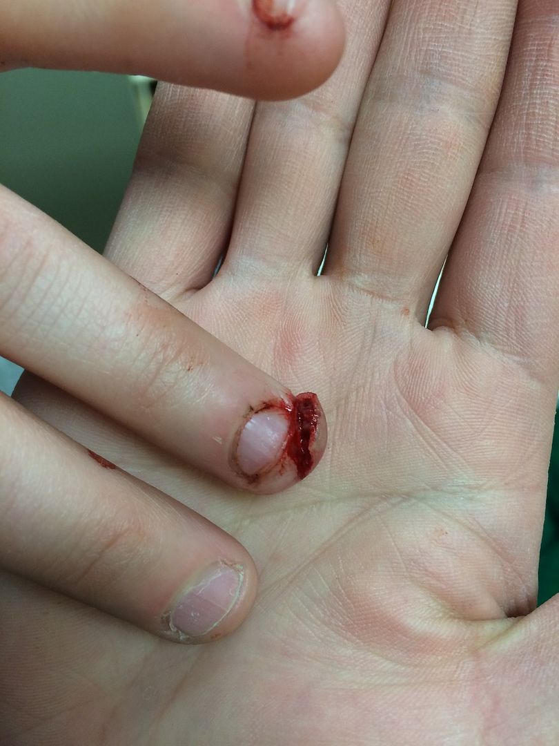 My Friend Slammed Her Finger In The Door The Other Day Pics