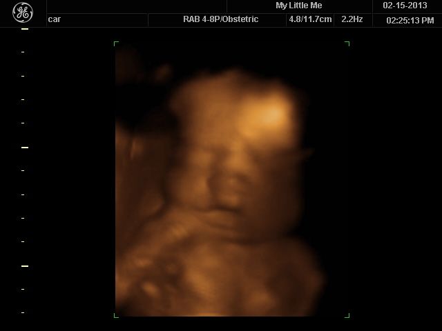 3d/4d ultrasound of LO at 26 weeks :) | BabyCenter